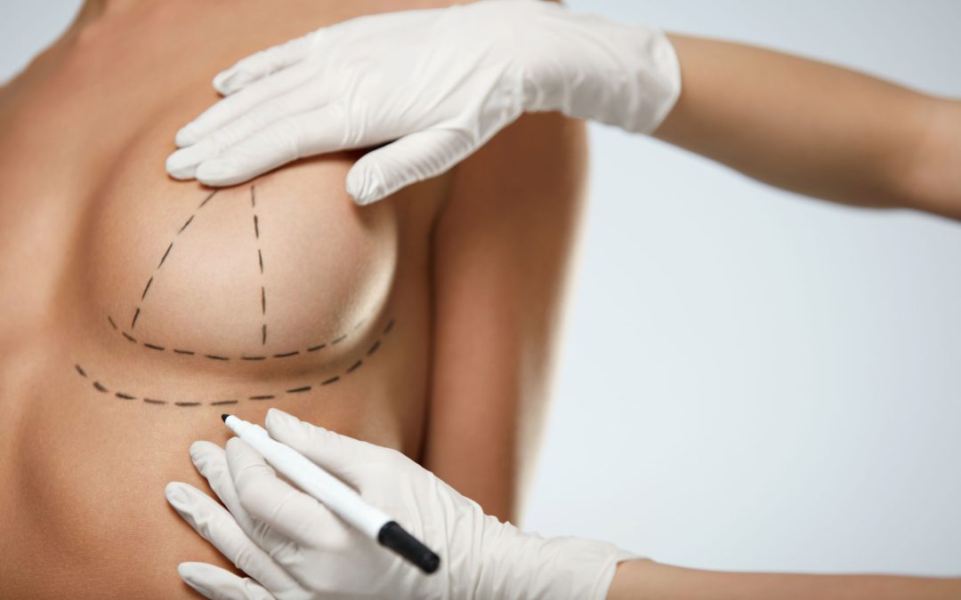 Rediscover Confidence: The Comprehensive Guide to Breast Lift Surgery