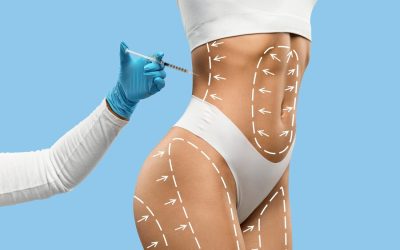 Plastic Surgery In Nairobi