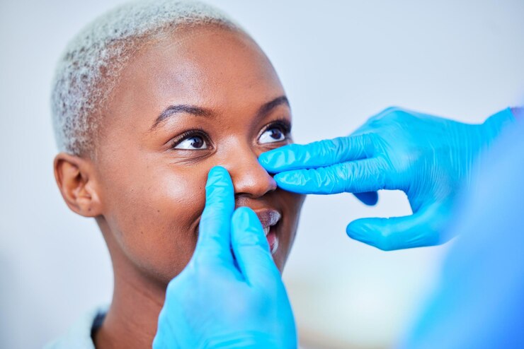 Rhinoplasty at Syn Plastics and Aesthetic Kenya