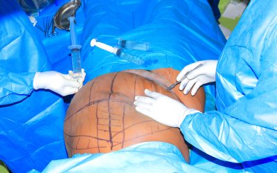 Plastic Surgery Nairobi