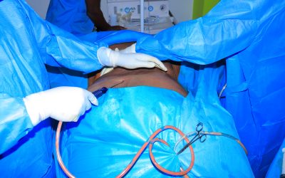 Plastic Surgery in Kenya