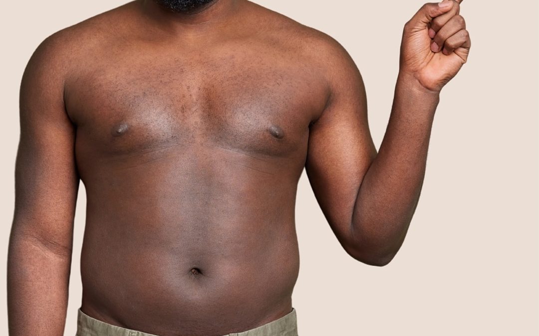 Male Breast Reduction in Kenya