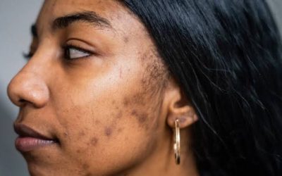 Dermatologist in Nairobi