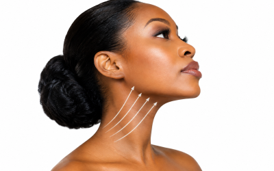 Neck Lift