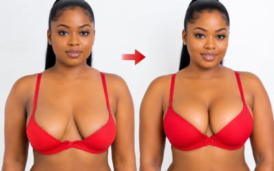 Breast Lift in Kenya