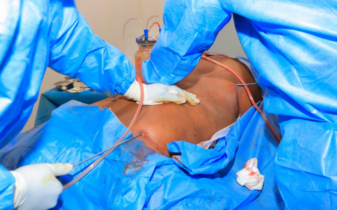 Plastic Surgery in Kenya